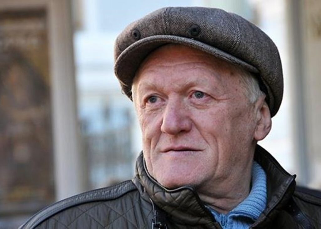 Відомий продюсер розповів про невдалі косметологічні процедури